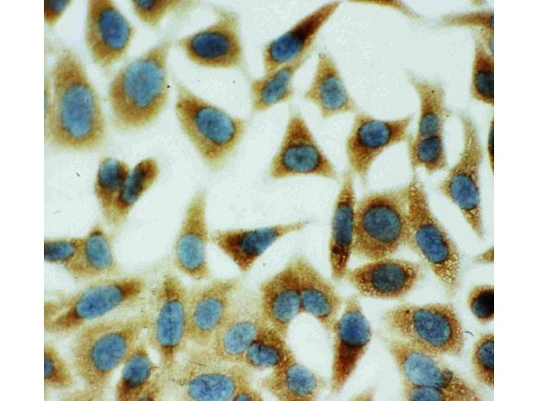 Immunocytochemistry of Anti-Annexin V